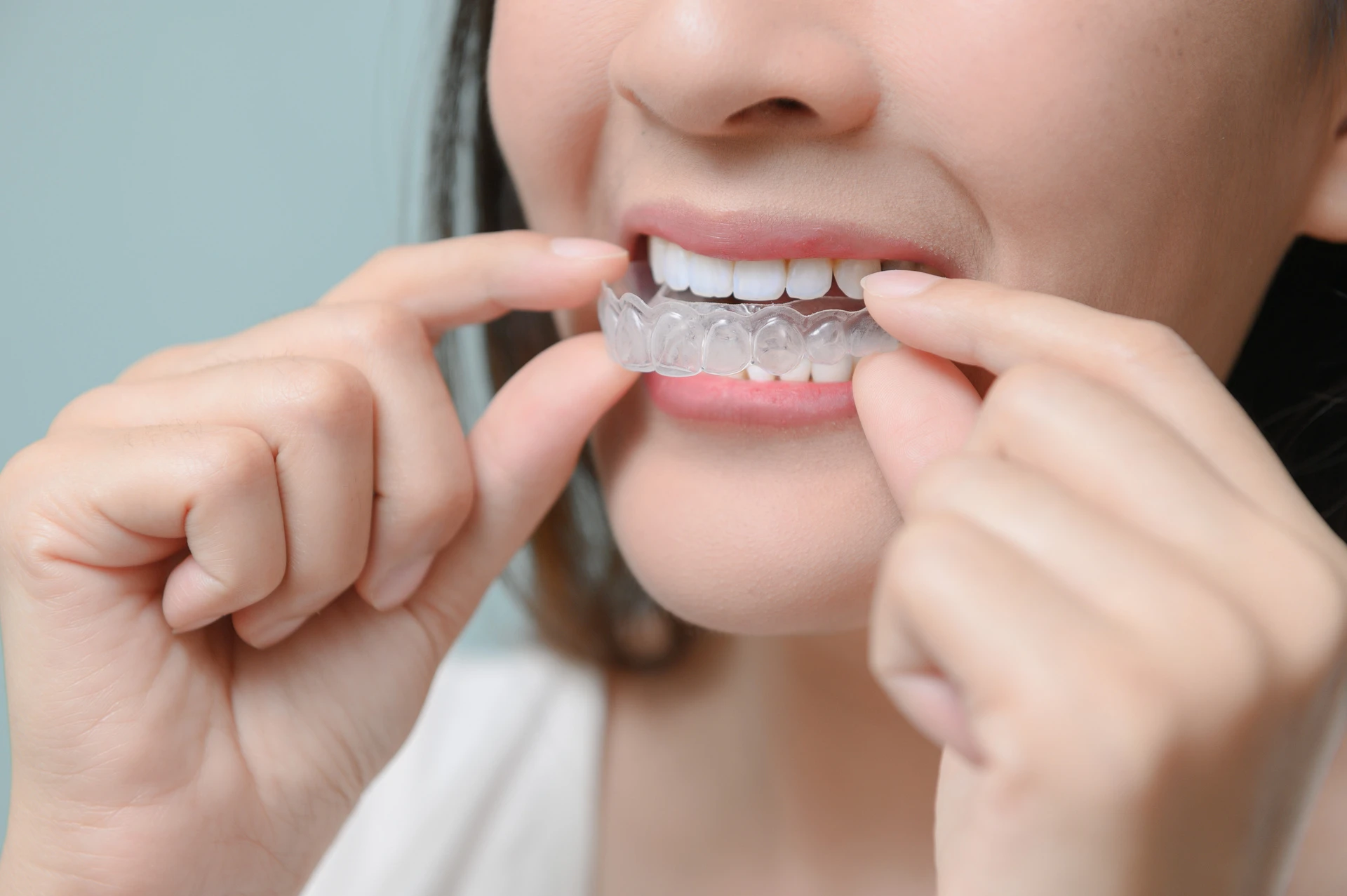 dentist1_lp1__cms-6344-bg_image__AdobeStock_110569078
